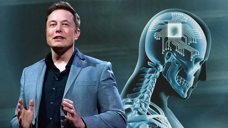 Elon Musk, İlk Defa Bir İnsana Neuralink Çipi Takıldığını Duyurdu
