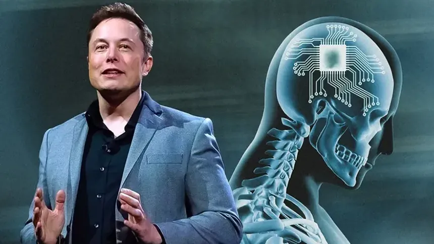 Elon Musk, İlk Defa Bir İnsana Neuralink Çipi Takıldığını Duyurdu