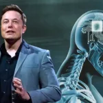 Elon Musk, İlk Defa Bir İnsana Neuralink Çipi Takıldığını Duyurdu