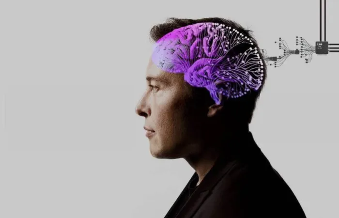 Neuralink Projesinde Beynine Çip Takılan Kişinin Videosu Paylaşıldı!