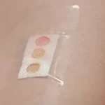 Diyabet Hastaları İçin "Yara Bandına Benzeyen" Cihaz Geliştirildi!