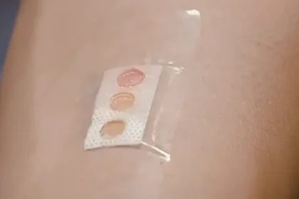 Diyabet Hastaları İçin "Yara Bandına Benzeyen" Cihaz Geliştirildi!